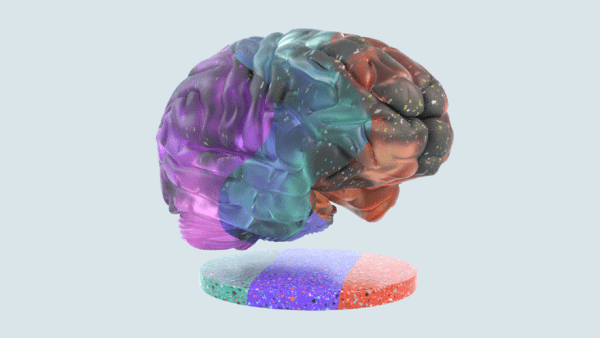3-D brain with some areas of darkness signifying mild cognitive impairment